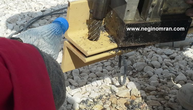 neginomran.com-brace-111